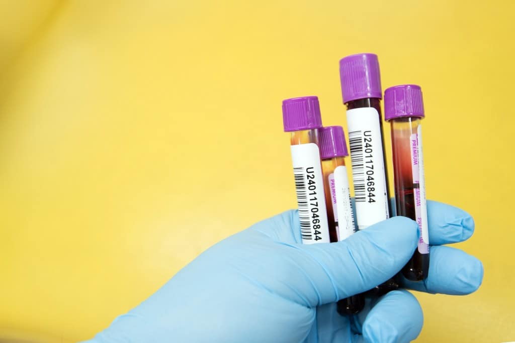New Blood Test Can Detect Cancer Years Before Symptoms Appear